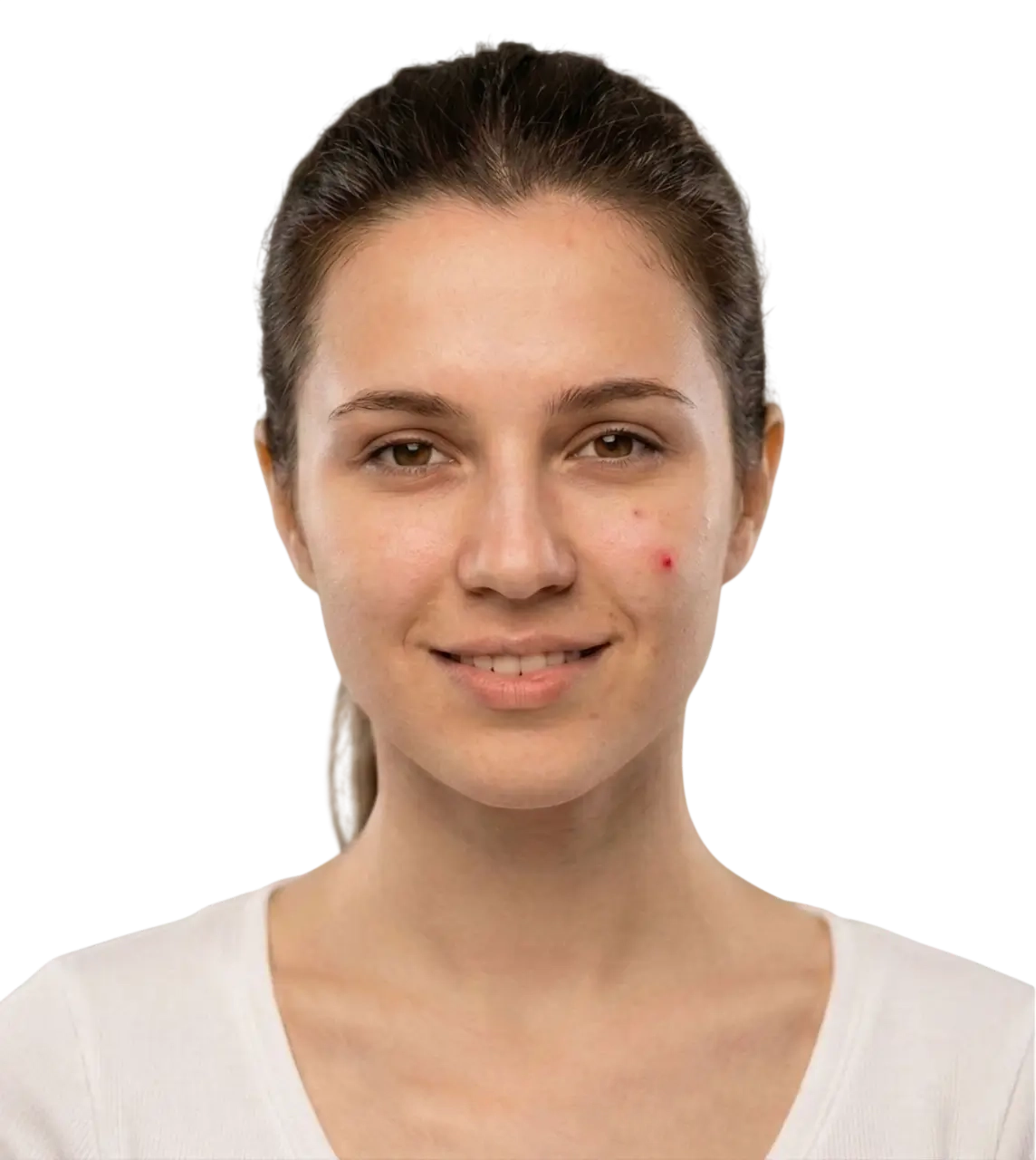 image comparison before